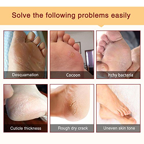 Foot Peel Mask 3 Pack， Exfoliator Peel Off Calluses Dead Skin Callus Remover，Baby Soft Smooth Touch Feet-Men Women (Lavender) - hopeschwing