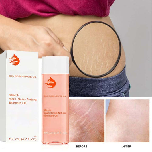 Optimal Oil Collagen Boost Firming & Lifting Skincare Oil, Bio Oil Skincare Oil Stretch Marks, Suitable for All Skin Types (1pcs) - hopeschwing